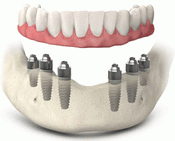 ����������� ����������� �����